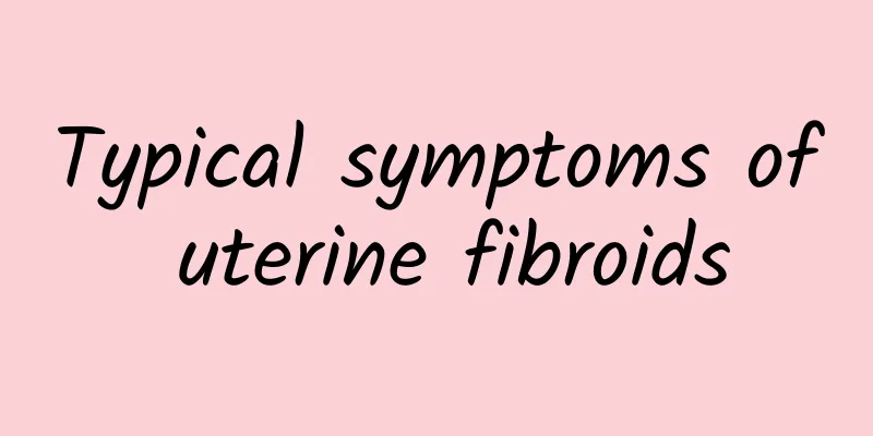 Typical symptoms of uterine fibroids