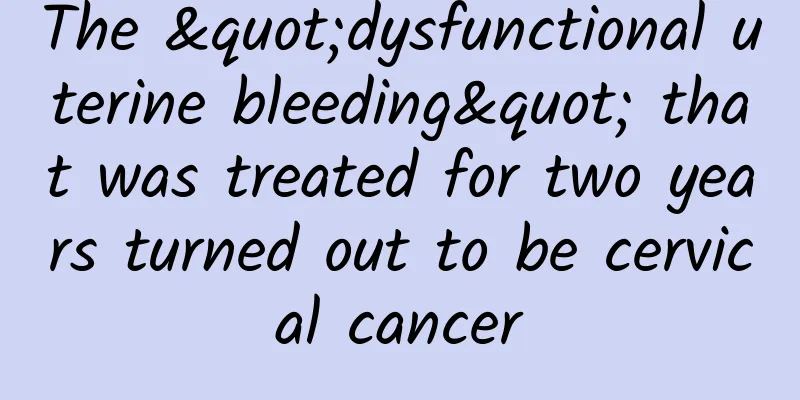 The "dysfunctional uterine bleeding" that was treated for two years turned out to be cervical cancer