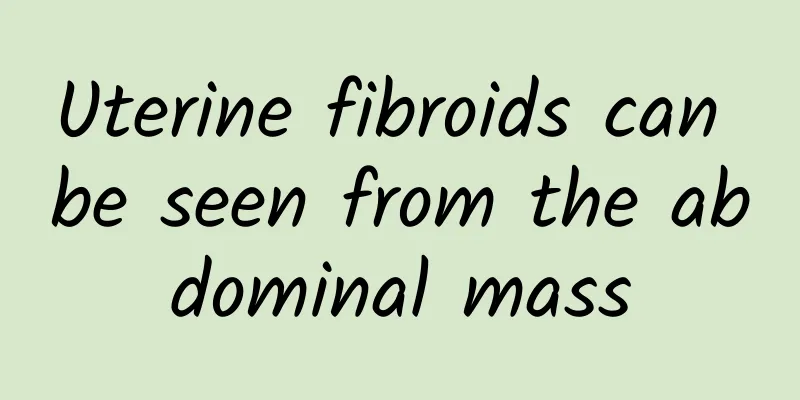 Uterine fibroids can be seen from the abdominal mass