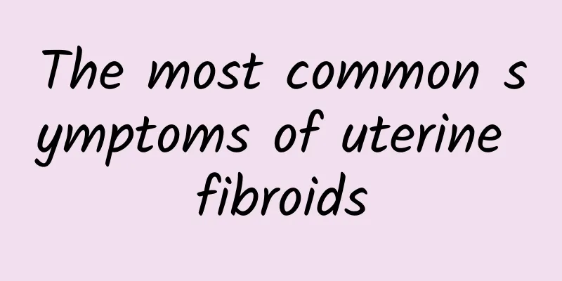 The most common symptoms of uterine fibroids