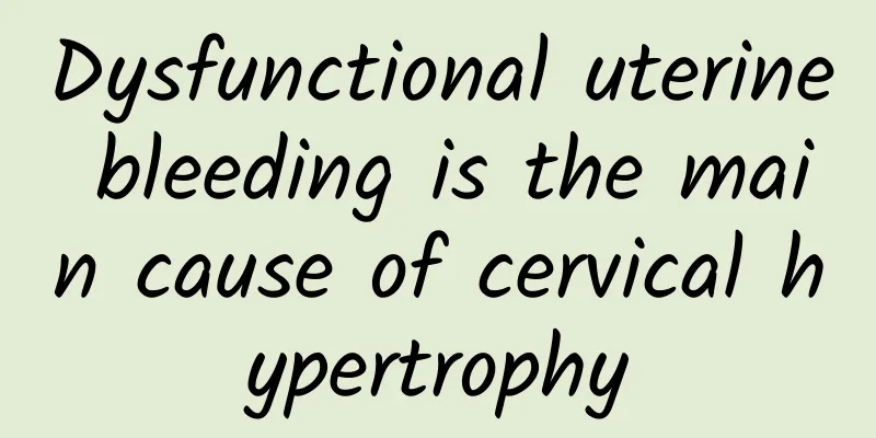 Dysfunctional uterine bleeding is the main cause of cervical hypertrophy