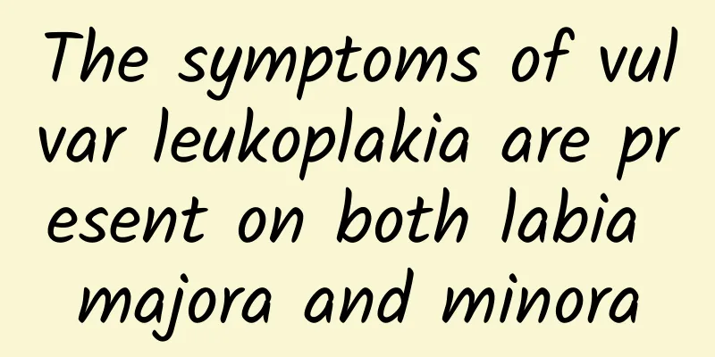The symptoms of vulvar leukoplakia are present on both labia majora and minora