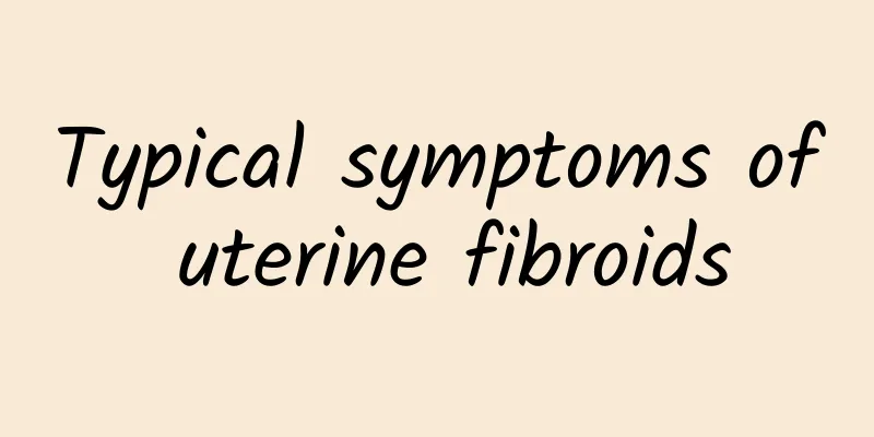 Typical symptoms of uterine fibroids