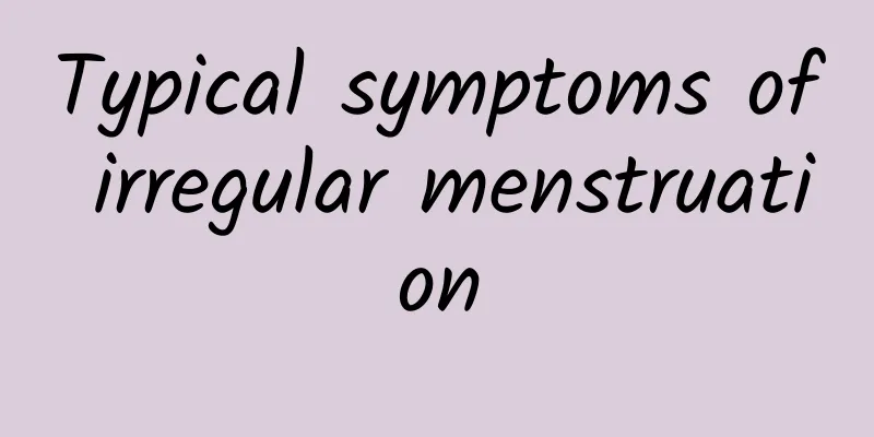 Typical symptoms of irregular menstruation