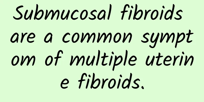 Submucosal fibroids are a common symptom of multiple uterine fibroids.