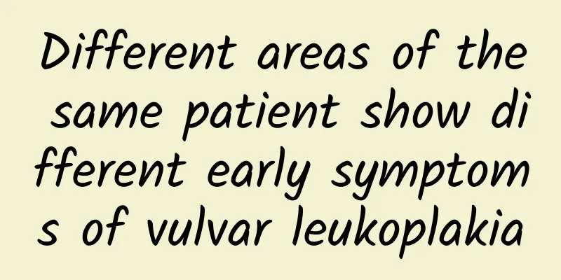 Different areas of the same patient show different early symptoms of vulvar leukoplakia