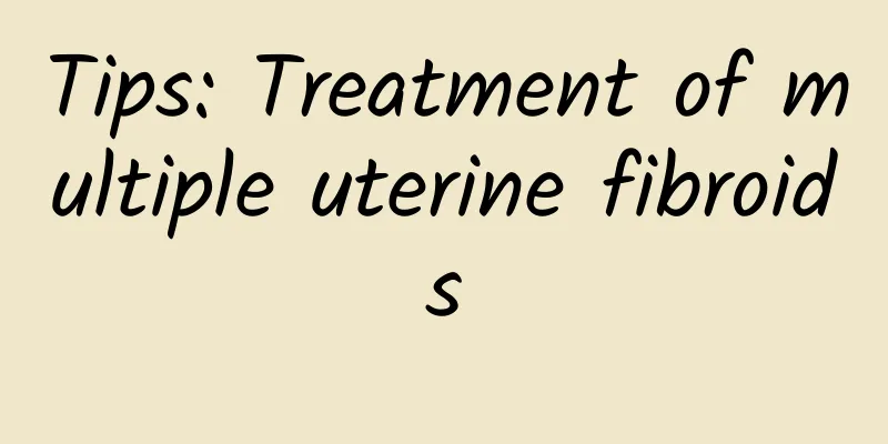 Tips: Treatment of multiple uterine fibroids