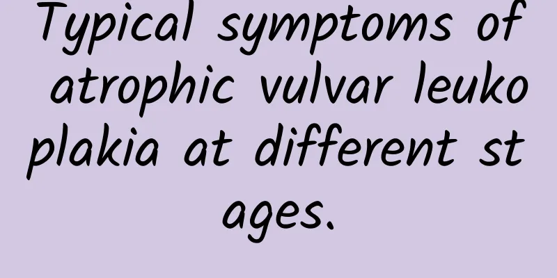 Typical symptoms of atrophic vulvar leukoplakia at different stages.